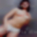 Alexandria disease naked girls